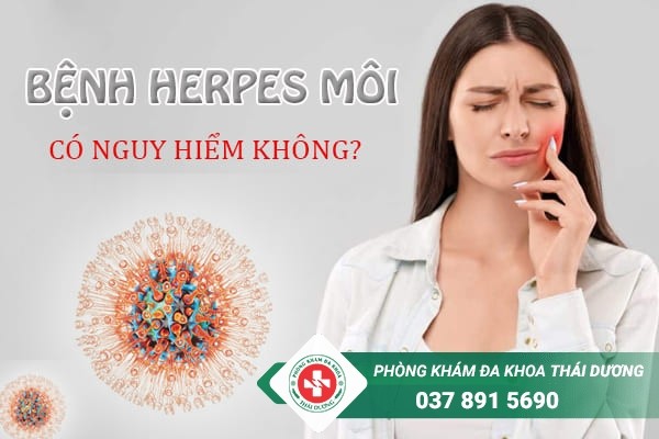 Bệnh Herpes môi khiến người bệnh gặp khó khăn trong việc ăn uống, giao tiếp