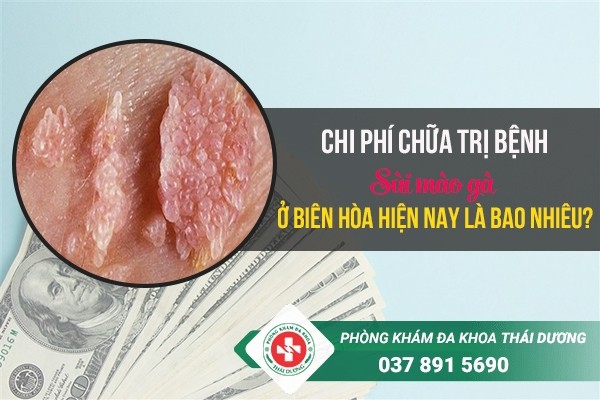 Chi phí chữa trị bệnh sùi mào gà ở Biên Hòa hiện nay là bao nhiêu?