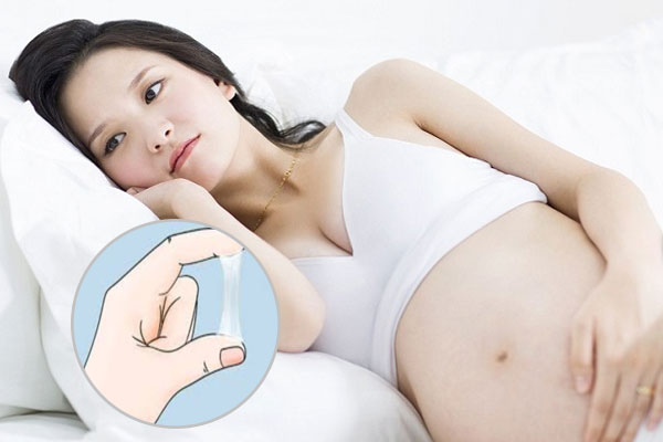 Ra nhiều huyết trắng khi mang thai là triệu chứng rất thường gặp