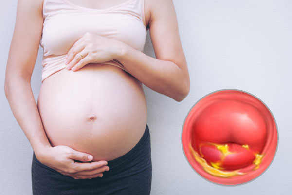 Viêm loét cổ tử cung khi mang thai không phải là trường hợp hiếm gặp