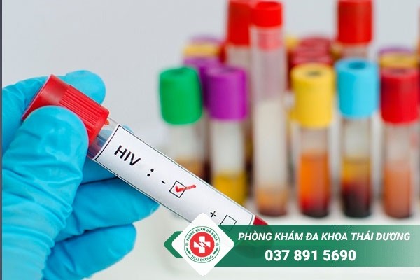 Xét nghiệm là phương pháp giúp xác định virus HIV chính xác nhất