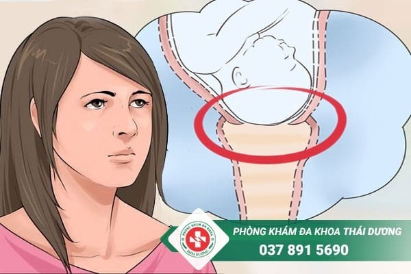 Thai phụ bị hở eo tử cung sẽ được chỉ định khâu vòng cổ tử cung