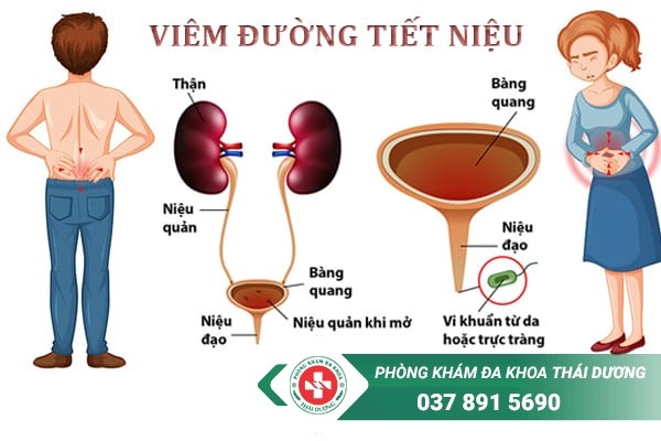 Chi phí điều trị viêm đường tiết niệu tại Biên Hòa – Đồng Nai