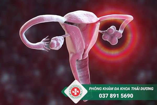 Buồng trứng đa nang là căn bệnh thường gặp ở phụ nữ trong độ tuổi sinh đẻ
