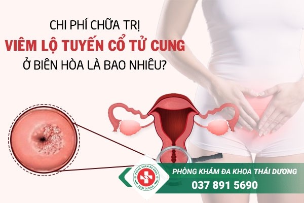 Chi phí chữa trị bệnh viêm lộ tuyến cổ tử cung ở Biên Hòa là bao nhiêu