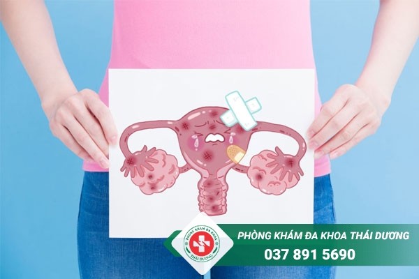 Viêm nội mạc tử cung ảnh hưởng đến sức khỏe sinh sản của chị em nếu không chữa sớm
