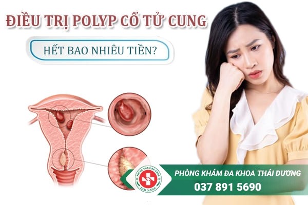 Chi phí điều trị Polyp cổ tử cung phụ thuộc vào tình trạng bệnh của nữ giới