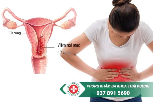 Viêm nội mạc tử cung có thể gây vô sinh nếu không điều trị sớm