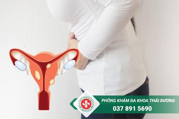 U xơ tử cung là tình trạng thường gặp ở chị em nữ giới