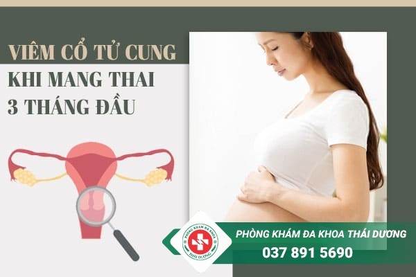 Viêm cổ tử cung khi mang thai 3 tháng đầu là tình trạng thường gặp