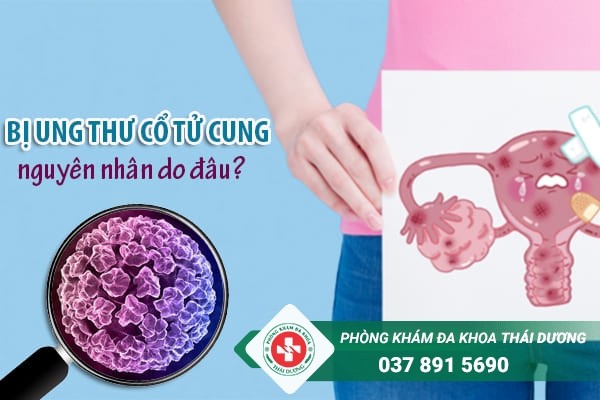 Virus HPV là tác nhân gây nên bệnh ung thư cổ tử cung ở phụ nữ