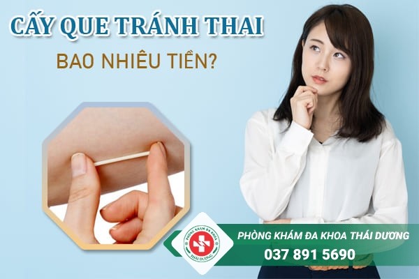 Cấy que tránh thai bao nhiêu tiền tại Biên Hòa – Đồng Nai?