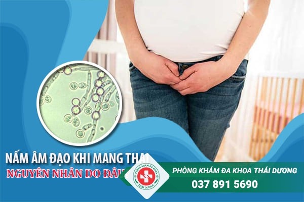 Nấm Candida là tác nhân chính gây nấm âm đạo khi mang thai