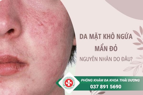 Nguyên nhân da mặt khô ngứa mẩn đỏ và cách điều trị